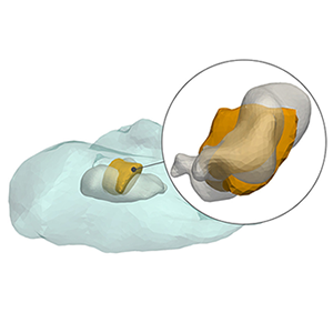 Image of Patient-specific Multi-Scale Tumor Growth Modelling Model in FLAME GPU 2